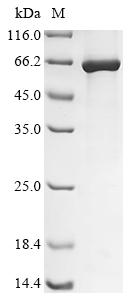 Recombinant Human adenovirus C serotype 5 Early E1A protein
