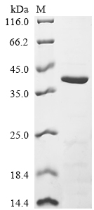 Recombinant Human HLA class I histocompatibility antigen,B alpha chain (HLA-B), partial