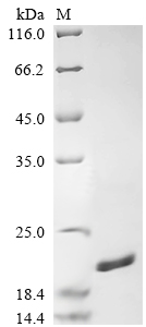 Recombinant Legionella pneumophila Peptidoglycan-associated lipoprotein (pal)