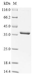 Recombinant Autographa californica nuclear polyhedrosis virus Uncharacterized 30.6 kDa protein in IAP2-VLF1 intergenic region