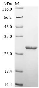 Recombinant Escherichia coli Tetracycline repressor protein class E (tetR)