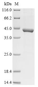 Recombinant Human rhinovirus 1B Genome polyprotein, partial