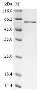 Recombinant Streptococcus pneumoniae serotype 2 Pneumolysin (ply) (146:A→Missing), partial