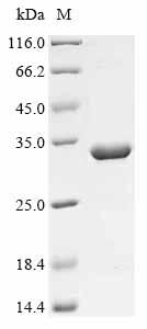 Recombinant Vaccinia virus Scaffold protein OPG125 (OPG125), partial
