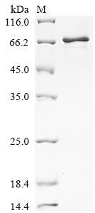 Recombinant Mouse Vitronectin (Vtn)