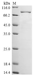 Recombinant Rat Tripartite motif-containing protein 2 (Trim2)