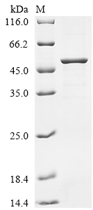 Recombinant Human Tapasin (TAPBP), partial