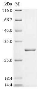 Recombinant Rat Stathmin-2 (Stmn2)