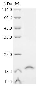 Recombinant Human Thiamine transporter 1 (SLC19A2), partial
