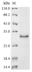 Recombinant Human Reduced folate transporter (SLC19A1), partial