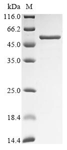 Recombinant Human Pregnancy-specific beta-1-glycoprotein 1 (PSG1)