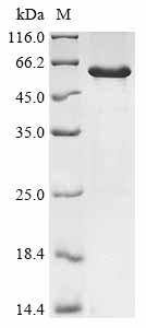 Recombinant Human Protein phosphatase 1 regulatory subunit 3G (PPP1R3G)