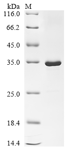 Recombinant Escherichia phage T7 T7 RNA polymerase (1), partial