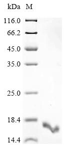 Recombinant Human P2Y purinoceptor 1 (P2RY1), partial