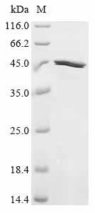 Recombinant Rat Neurofilament heavy polypeptide (Nefh), partial