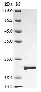 Recombinant Ailuropoda melanoleuca Fanconi-associated nuclease 1 (FAN1), partial
