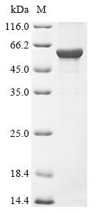Recombinant Human Keratin, type I cytoskeletal 16 (KRT16)