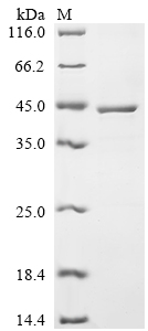 Recombinant Human Estradiol 17-beta-dehydrogenase 1 (HSD17B1)