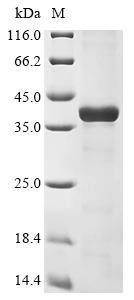 Recombinant Mouse Histamine N-methyltransferase (Hnmt)