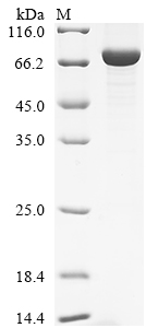 Recombinant Human Glycerol-3-phosphate dehydrogenase, mitochondrial (GPD2)