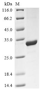 Recombinant Rat Fibroblast growth factor 20 (Fgf20)