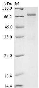 Recombinant Human Eosinophil peroxidase (EPX)