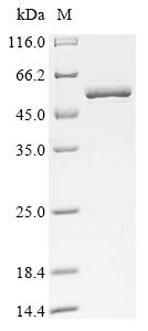 Recombinant Human Eukaryotic initiation factor 4A-I (EIF4A1)