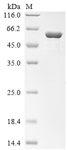 Recombinant Human Desmin (DES)