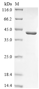 Recombinant Human Ceroid-lipofuscinosis neuronal protein 5 (CLN5)