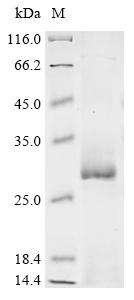 Recombinant Human Acetylcholine receptor subunit gamma (CHRNG), partial