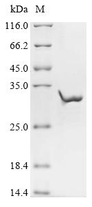 Recombinant Human Acetylcholine receptor subunit epsilon (CHRNE), partial