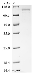 Recombinant Human Major centromere autoantigen B (CENPB)
