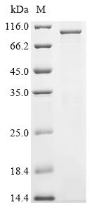 Recombinant Human Cyclin-T1 (CCNT1)