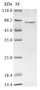 Recombinant Human Cyclin-A2 (CCNA2)