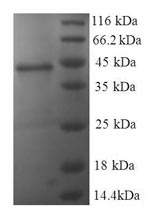 Recombinant Human Nucleoside diphosphate kinase A (NME1)