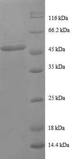 Recombinant Human Proteasome subunit beta type-2 (PSMB2)