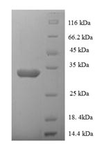 Recombinant Human N-alpha-acetyltransferase 38, NatC auxiliary subunit (NAA38)