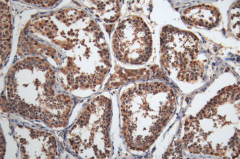 MAGEA4 Antibody