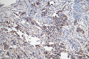 MAGEA4 Antibody
