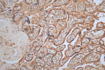 MAGEA4 Antibody