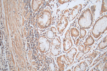 MAGEA4 Antibody