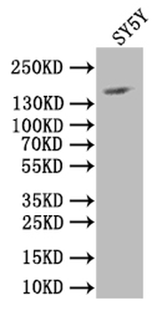 NCAM1 Antibody