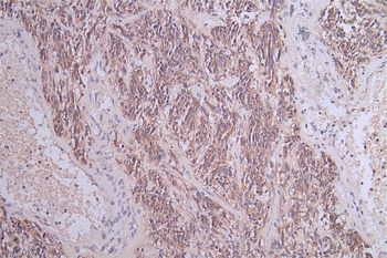 NCAM1 Antibody