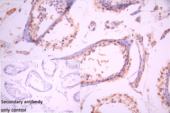 GFAP Antibody