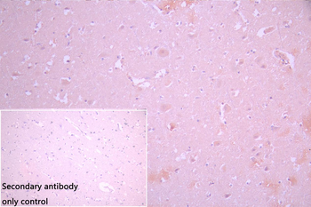 GFAP Antibody