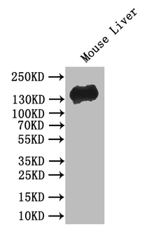 CDH1 Antibody