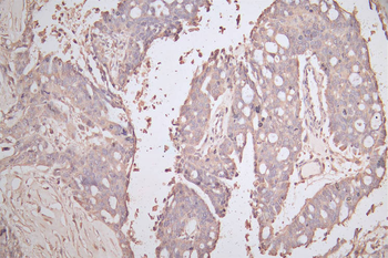 CDH1 Antibody
