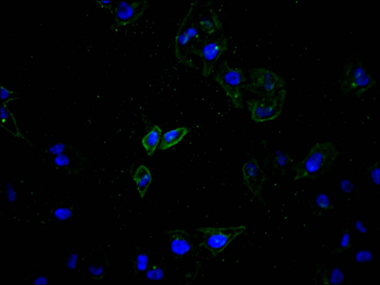 ATP7B Antibody