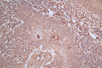MS4A1 Antibody