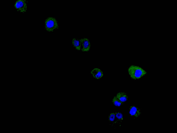 MS4A1 Antibody